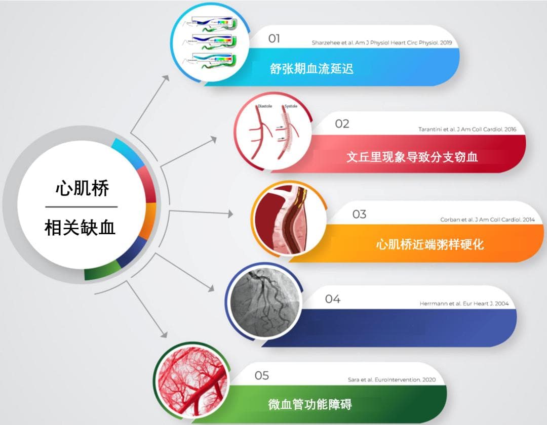 从形成与发展，说清什么是心肌桥