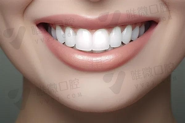 根管治疗后可以吃些什么食物？有哪些注意事项需要了解？