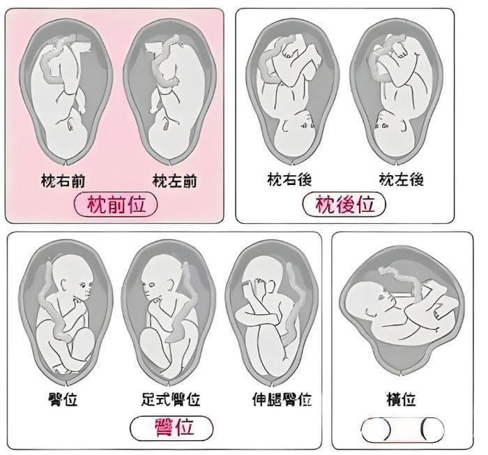 如何判断胎位正不正？这几种自测方法很简单，即使不正也不用怕！