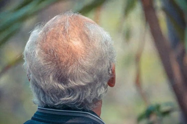 白发与癌症风险：科学解读“白发抗癌”误区