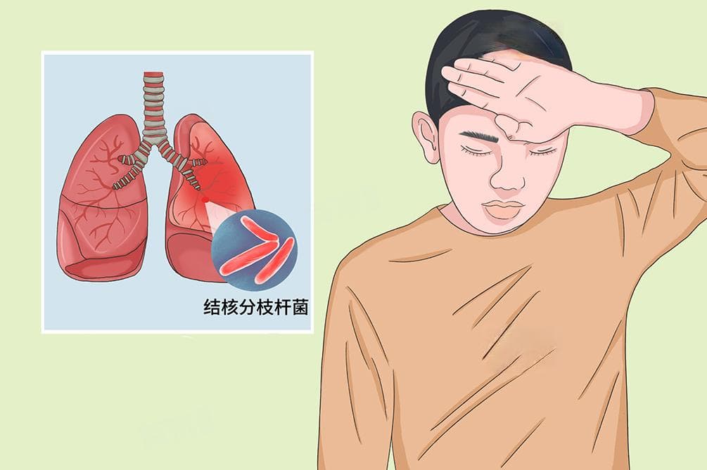 肺结核定义