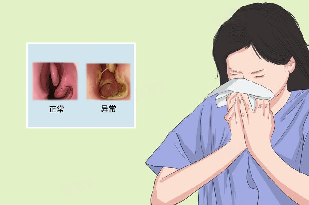 什么是萎缩性鼻炎