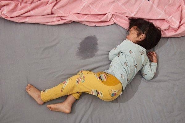 孩子晚上睡觉总是出汗是什么原因