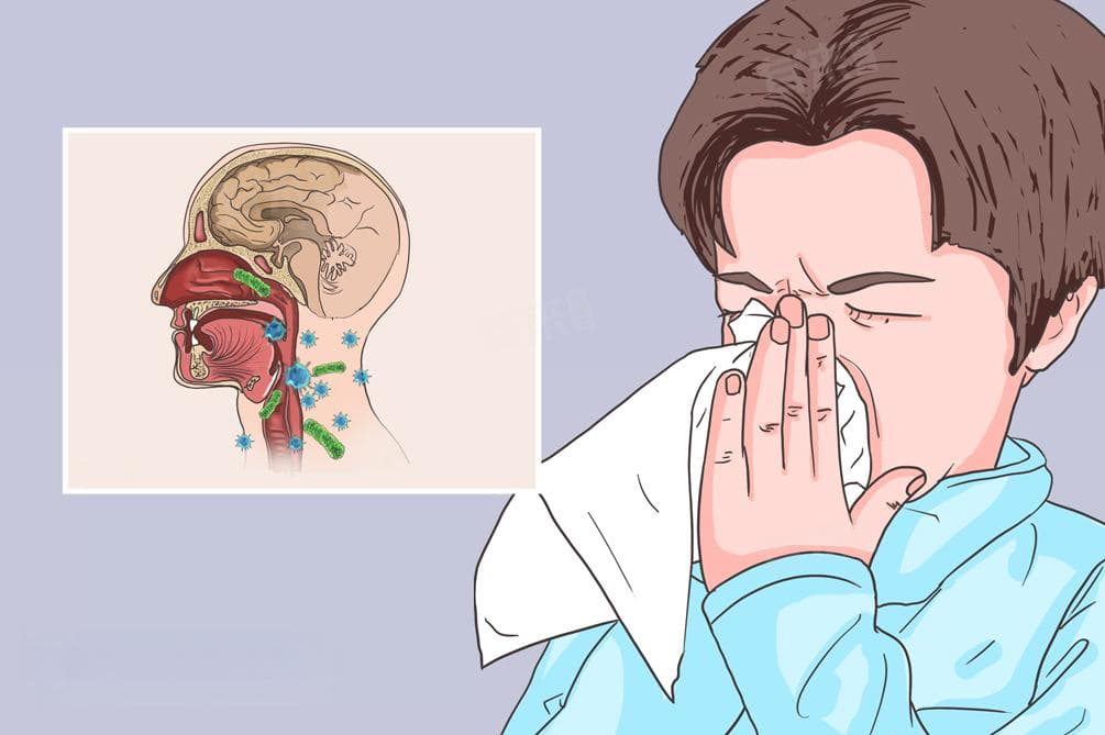风寒感冒可以吃小柴胡颗粒吗