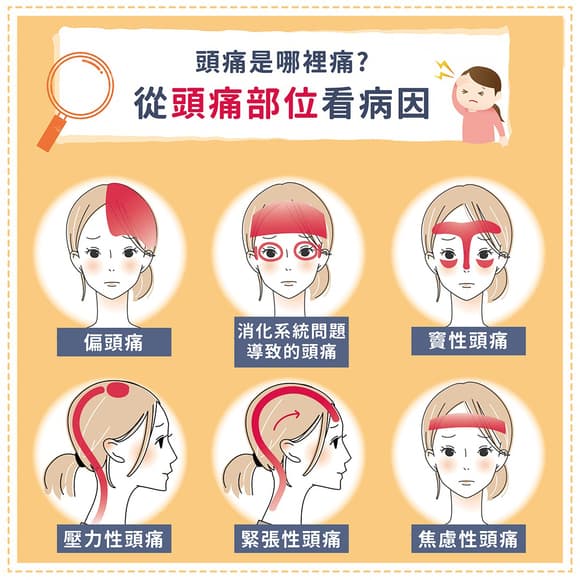 头痛是哪里痛？从头痛部位看病因