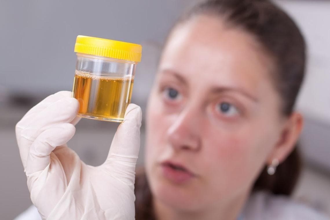 高尿酸血症的三大晨起预警信号及预防指南