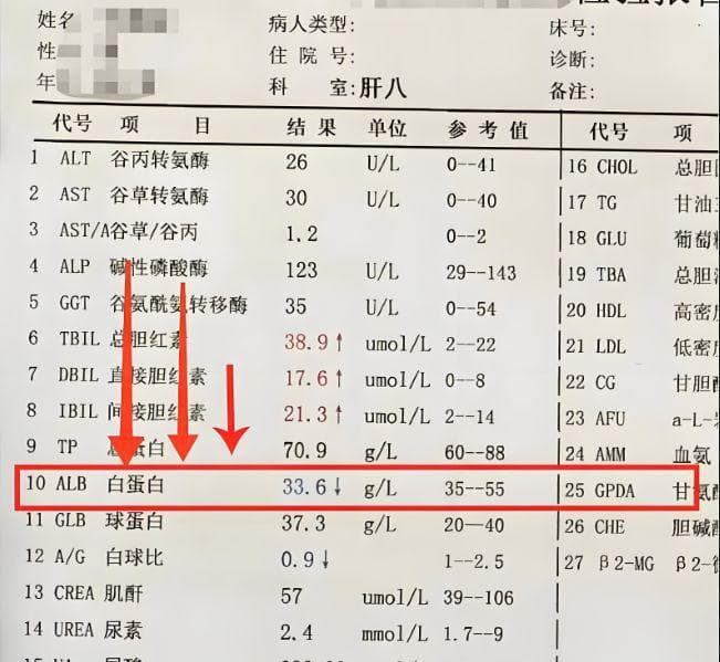 肝硬化治疗效果怎样？这几项指标来评估