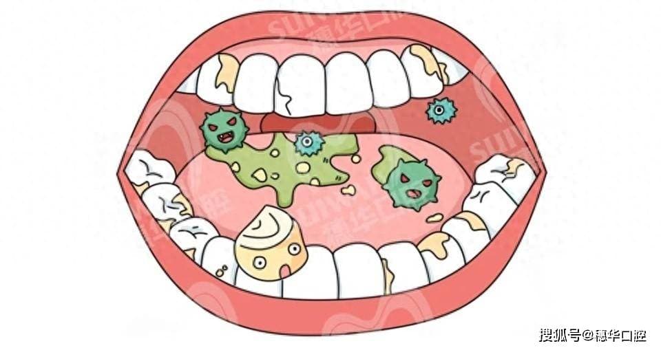 牙病多半是吃出来的？6种口腔细菌最爱的食物，你可能每天都在吃
