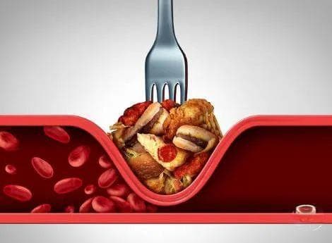 【每周科普】「吃对了，斑块自然退散！」——这些食物让你的动脉更健康