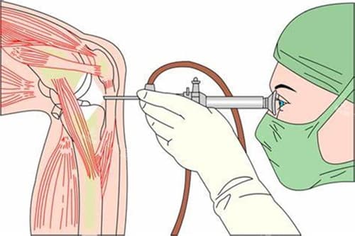 腿型矫正手术有哪些？看完你就了解腿型整形手术！