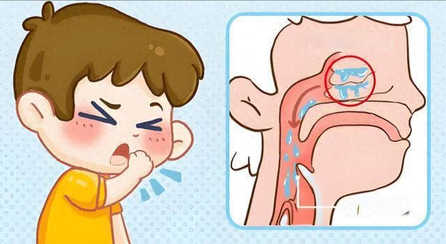 咳嗽却开鼻喷雾剂？揭开医生的“神操作”