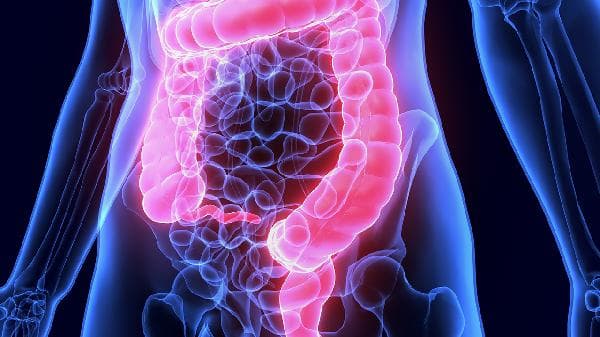 胃肠穿孔的症状、原因及治疗方法全解析