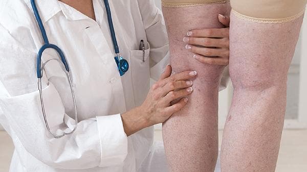 怎样可以减掉大象腿