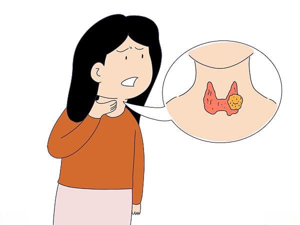 甲状腺结节患者适宜的饮食选择