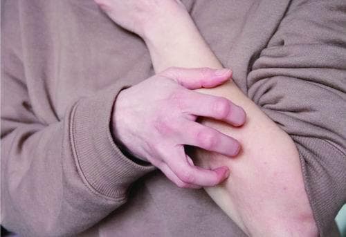挠痒痒为何让人愉悦？最新研究揭示免疫机制