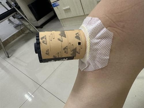 九江市风湿病医院风湿骨关节科诊疗特色介绍