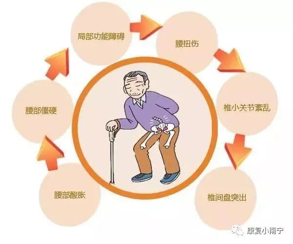 腰肌劳损的康复训练指南