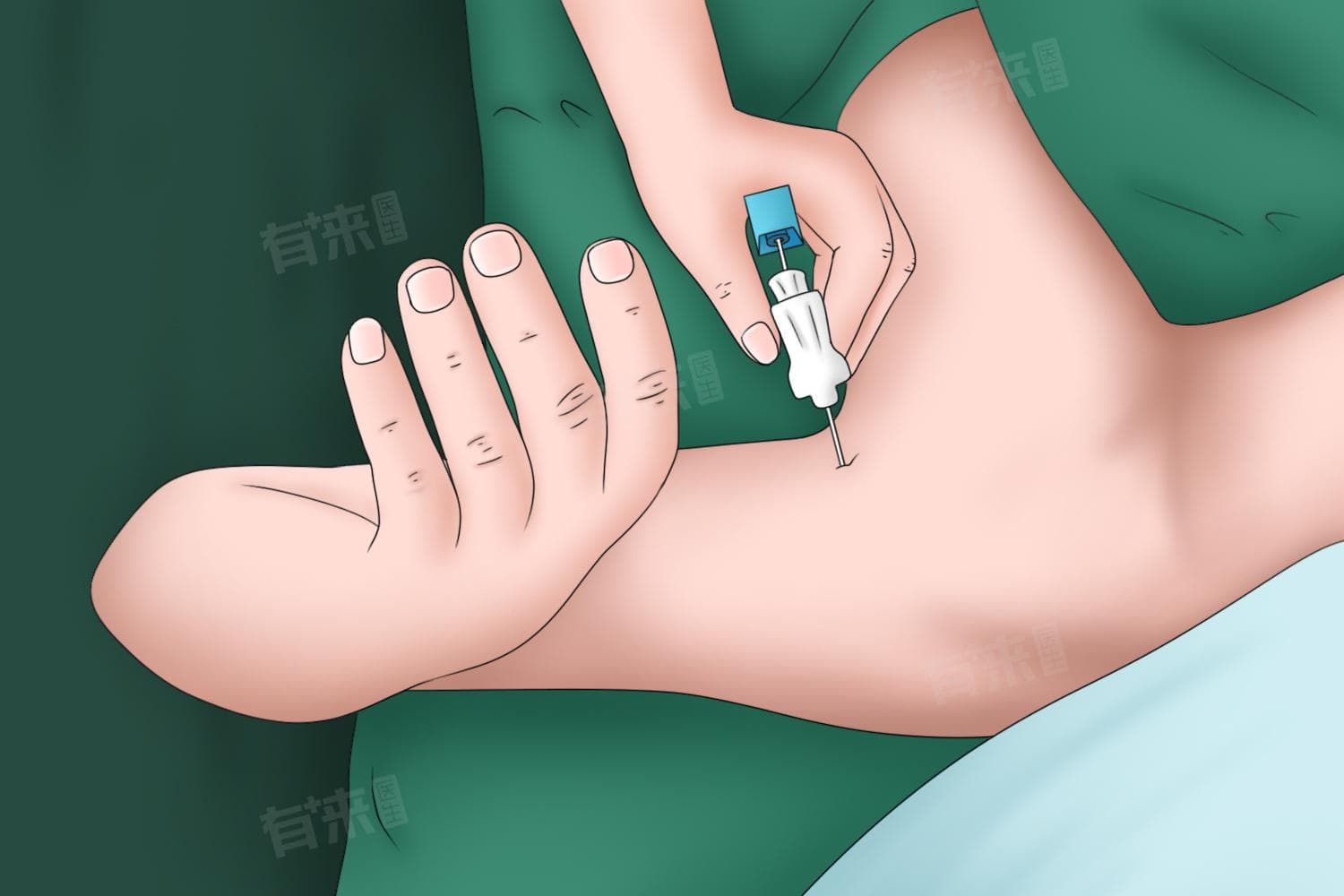 麻醉评估是怎么做的