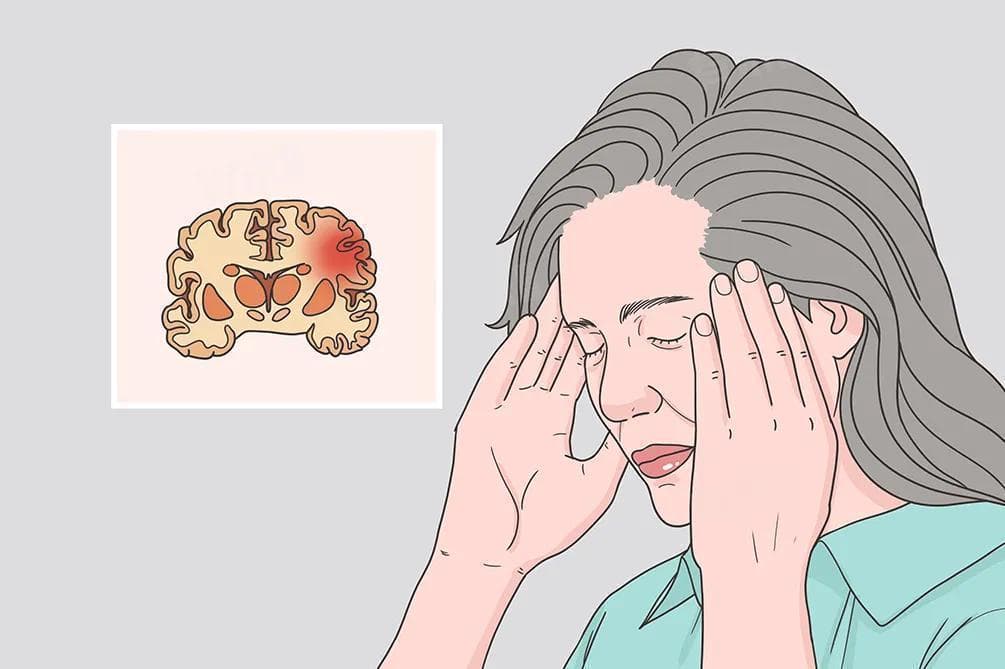 打哈欠是脑梗的前兆吗？
