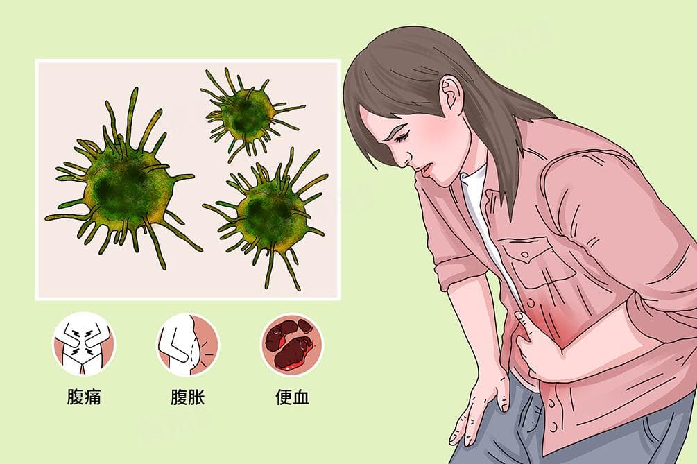 痢疾的症状和治疗方法