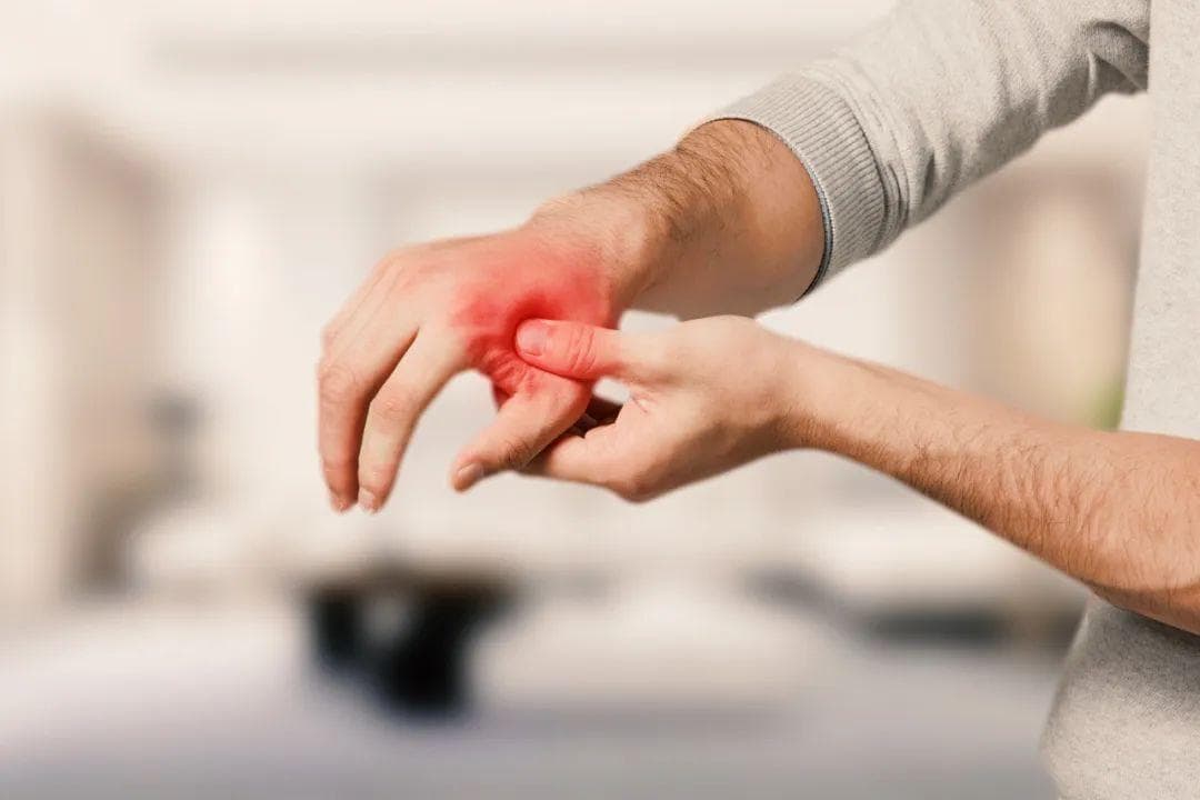 手腕上长个小包包？别怕，不一定是肿瘤