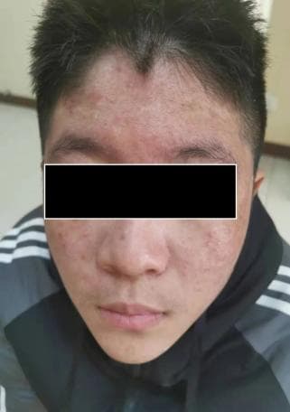 皮肤病治疗的多元路径：中医与西医的选择