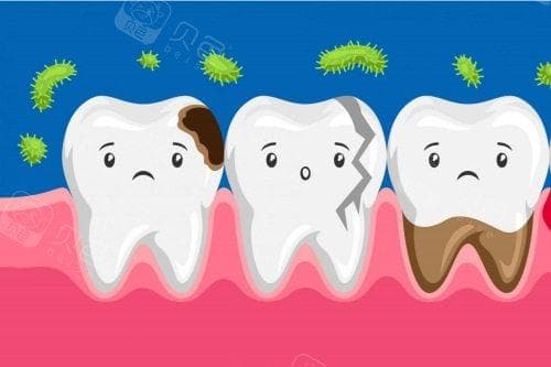 烂牙根不拔掉会影响旁边的牙吗？揭秘牙齿健康的秘密！