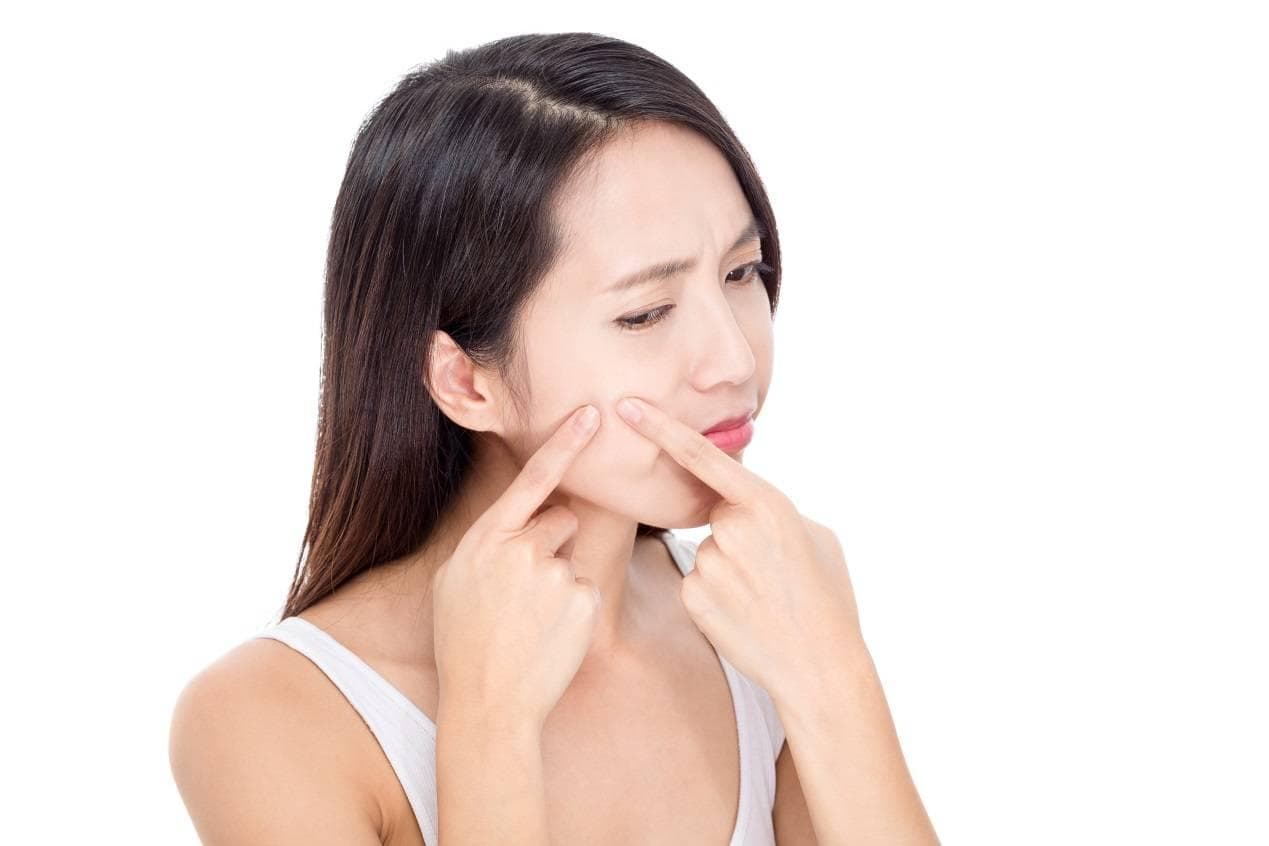 异维A酸软胶囊你用对了吗？痤疮患者用药前要知道这些