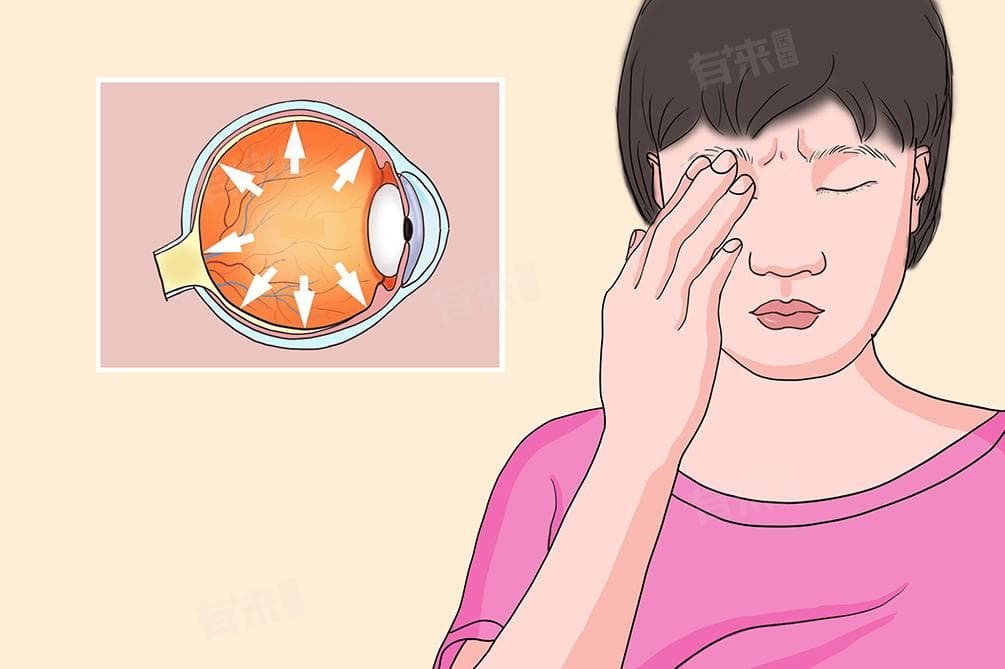 青光眼的病因是由什么引起的