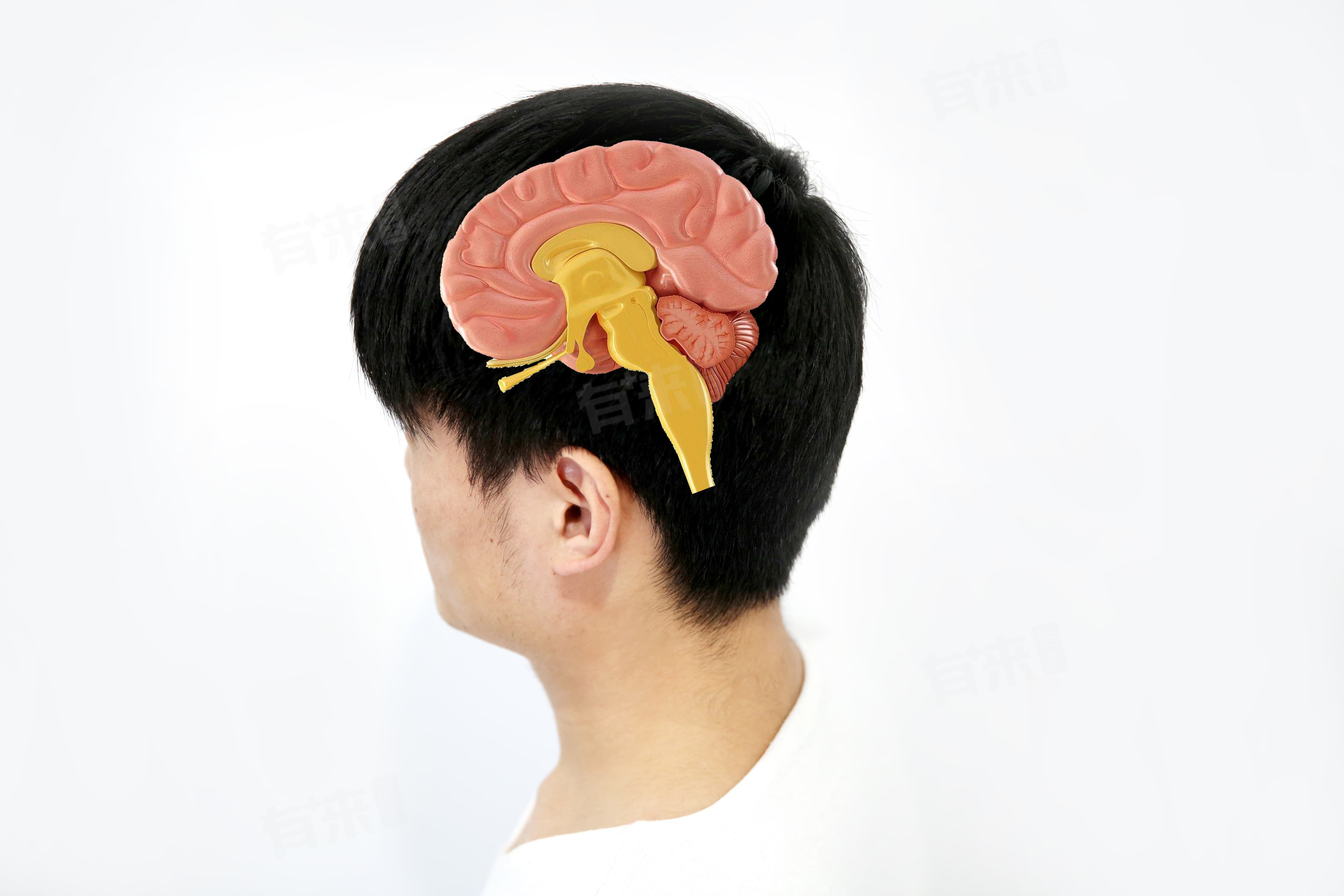 大脑供血系统的分类