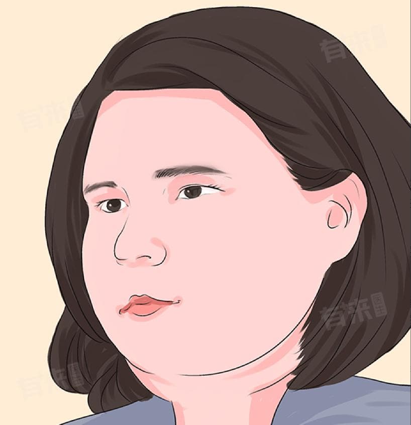 脸肿胀要警惕四种病