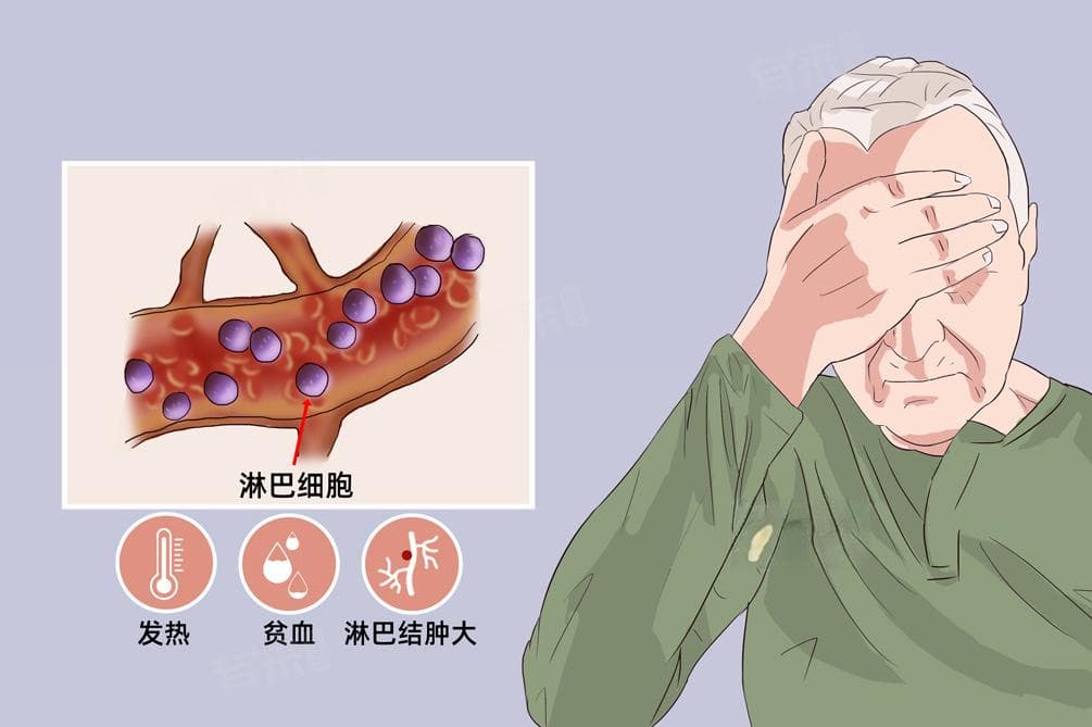 急性淋巴白血病的预后