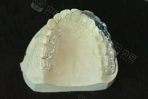 什么是颌垫？正畸专科医生详解颌垫的作用与原理