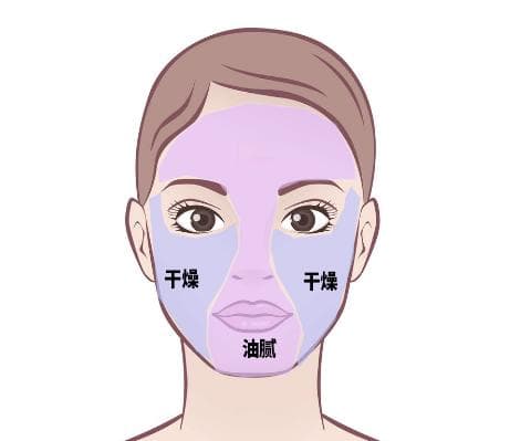 干皮但是T区出油是什么肤质
