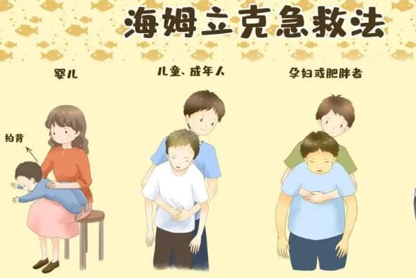 一文说清海姆立克急救法的操作步骤，附相关图片