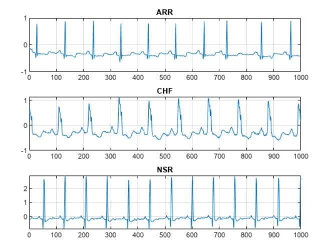 使用小波分析和深度学习对心电图 (ECG) 进行分类