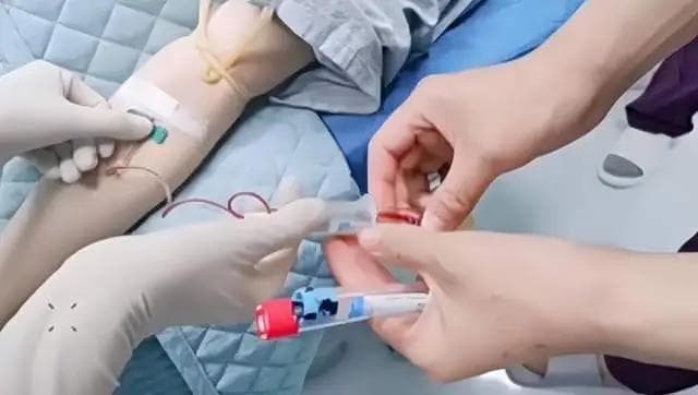 刺络拔罐与PRP疗法：传统与现代医学的奇妙共鸣