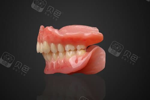 吸附性义齿和普通义齿有啥区别？升级版，使用更舒适方便