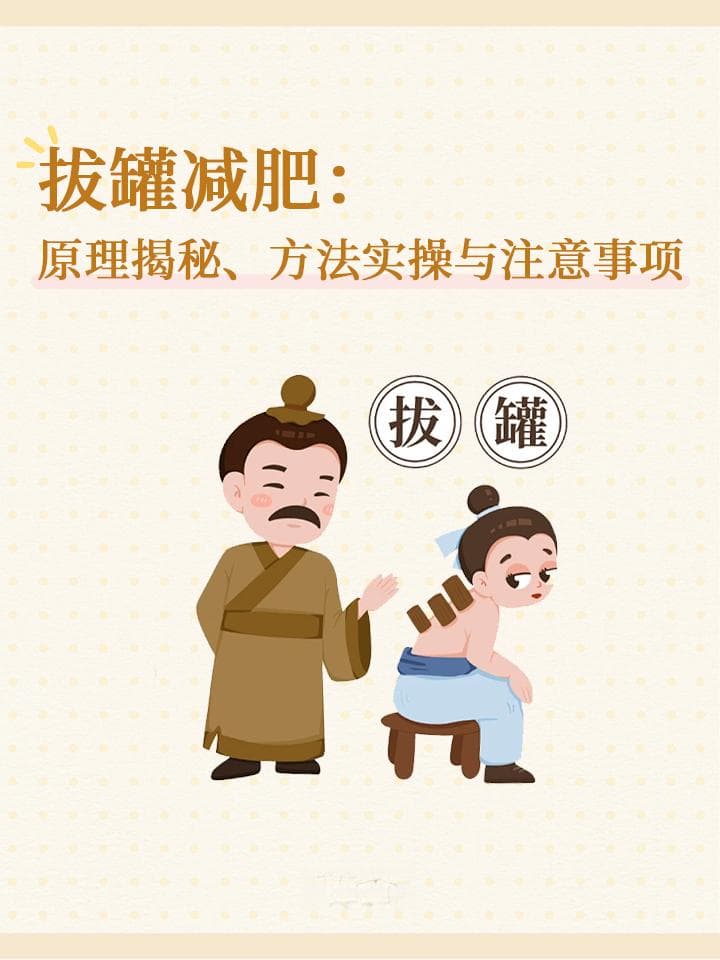 拔罐减肥：原理揭秘、方法实操与注意事项