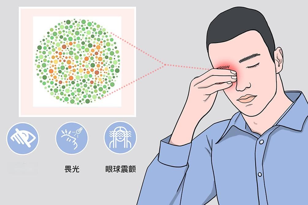 红绿色盲的遗传机制：从方式到规律的全面解析