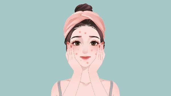 长痘痘了不能干什么