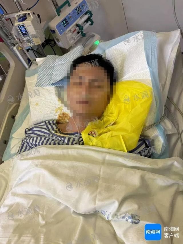 海南3人食用野生癞蛤蟆中毒，1人死亡2人仍在救治