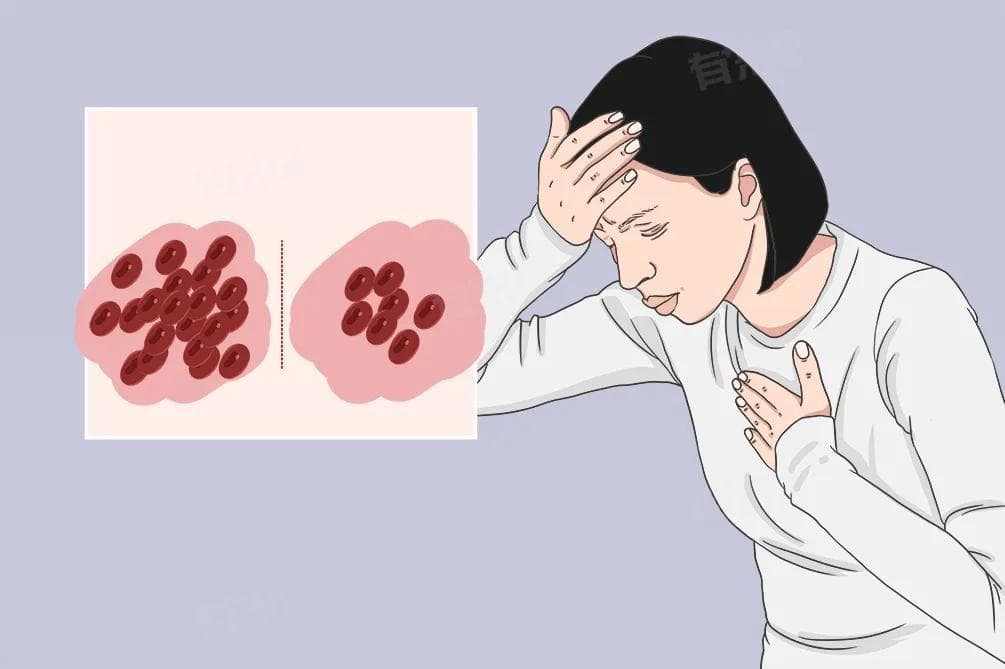 什么是缺铁性贫血