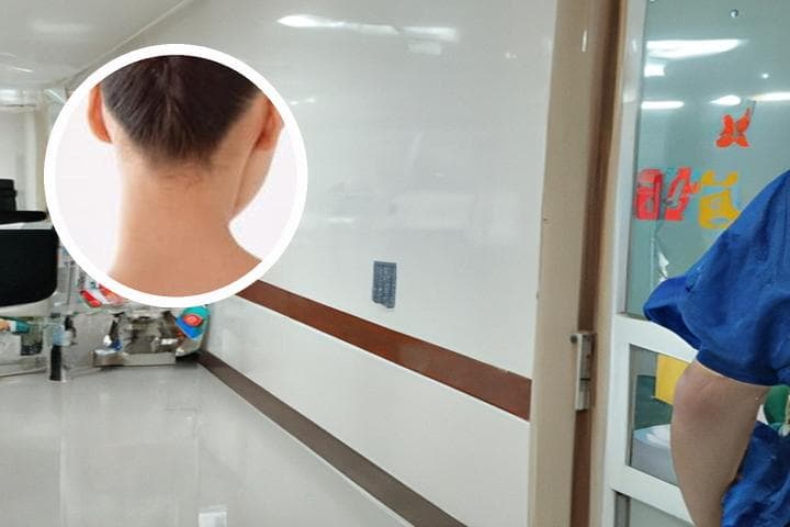 副银屑病的预防措施有哪些