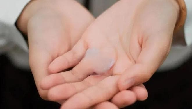 摆脱“水手”困扰：探秘手汗症