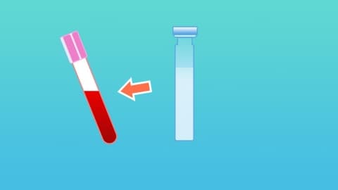 凝血功能检查对预防脑血管病有用吗
