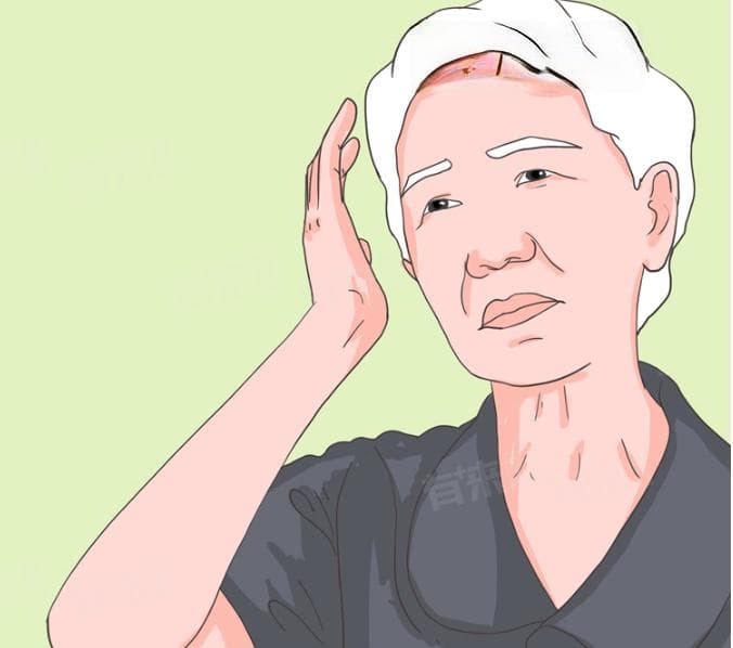 嗜血细胞综合征是什么病