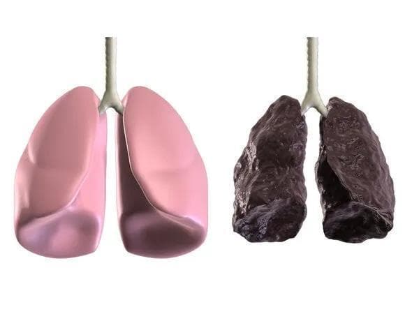 肺病中医辨证分型