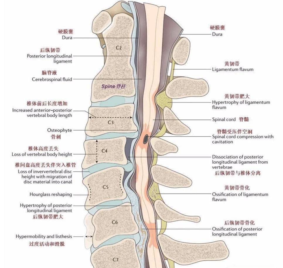 颈椎病的基础知识：了解它，从解剖开始