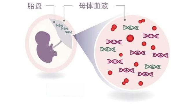 无创产前DNA要不要做？看完这些再决定